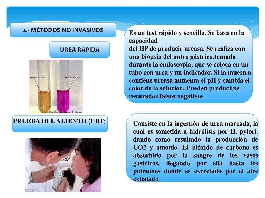 Test de ureasa en que consiste